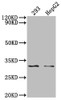 Western Blot<br />
 Positive WB detected in: 293 whole cell lysate, HepG2 whole cell lysate, <br />
 All lanes: NDUFS3 antibody at 1:2000<br />
 Secondary<br />
 Goat polyclonal to rabbit IgG at 1/50000 dilution<br />
 Predicted band size: 31, 15 KDa<br />
 Observed band size: 31 kDa<br />