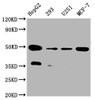 Western Blot<br />
 Positive WB detected in:HepG2 whole cell lysate, 293 whole cell lysate, U251 whole cell lysate, MCF-7 whole cell lysate<br />
 All lanes: UQCRC2 antibody at 1:2000<br />
 Secondary<br />
 Goat polyclonal to rabbit IgG at 1/50000 dilution<br />
 Predicted band size: 49 kDa<br />
 Observed band size: 49 kDa<br />