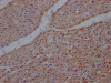 IHC image of CSB-RA229127A0HU diluted at 1:100 and staining in paraffin-embedded human heart tissue performed on a Leica BondTM system. After dewaxing and hydration, antigen retrieval was mediated by high pressure in a citrate buffer (pH 6.0). Section was blocked with 10% normal goat serum 30min at RT. Then primary antibody (1% BSA) was incubated at 4°C overnight. The primary is detected by a Goat anti-rabbit IgG polymer labeled by HRP and visualized using 0.05% DAB.