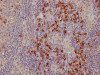 IHC image of CSB-RA213310A0HU diluted at 1:100 and staining in paraffin-embedded human lymph node tissue performed on a Leica BondTM system. After dewaxing and hydration, antigen retrieval was mediated by high pressure in a citrate buffer (pH 6.0). Section was blocked with 10% normal goat serum 30min at RT. Then primary antibody (1% BSA) was incubated at 4°C overnight. The primary is detected by a Goat anti-rabbit IgG polymer labeled by HRP and visualized using 0.05% DAB.