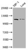 Western Blot<br />
 Positive WB detected in: THP-1 whole cell lysate, Mouse lung tissue<br />
 All lanes: MDA5 antibody at 1:2000<br />
 Secondary<br />
 Goat polyclonal to rabbit IgG at 1/50000 dilution<br />
 Predicted band size: 117, 26 kDa<br />
 Observed band size: 117 kDa<br />