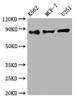 Western Blot<br />
 Positive WB detected in: K562 whole cell lysate, MCF-7 whole cell lysate, U251 whole cell lysate<br />
 All lanes: IKK beta antibody at 1:2000<br />
 Secondary<br />
 Goat polyclonal to rabbit IgG at 1/50000 dilution<br />
 Predicted band size: 87 kDa<br />
 Observed band size: 87 kDa<br />