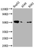 Western Blot<br />
 Positive WB detected in: HepG2 whole cell lysate, A549 whole cell lysate, K562 whole cell lysate<br />
 All lanes: Factor IX antibody at 1:2000<br />
 Secondary<br />
 Goat polyclonal to rabbit IgG at 1/50000 dilution<br />
 Predicted band size: 52 kDa<br />
 Observed band size: 52 kDa<br />