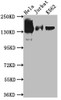 Western Blot<br />
 Positive WB detected in: Hela whole cell lysate, Jurkat whole cell lysate, K562 whole cell lysate<br />
 All lanes: SA2 antibody at 1:1000<br />
 Secondary<br />
 Goat polyclonal to rabbit IgG at 1/50000 dilution<br />
 Predicted band size: 142, 146 kDa<br />
 Observed band size: 142 kDa<br />