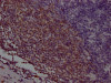 IHC image of CSB-RA280291A0HU diluted at 1:100 and staining in paraffin-embedded human appendix tissue performed on a Leica BondTM system. After dewaxing and hydration, antigen retrieval was mediated by high pressure in a citrate buffer (pH 6.0). Section was blocked with 10% normal goat serum 30min at RT. Then primary antibody (1% BSA) was incubated at 4°C overnight. The primary is detected by a Goat anti-rabbit IgG polymer labeled by HRP and visualized using 0.05% DAB.