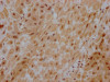 IHC image of CSB-RA917625A0HU diluted at 1:100 and staining in paraffin-embedded human placenta tissue performed on a Leica BondTM system. After dewaxing and hydration, antigen retrieval was mediated by high pressure in a citrate buffer (pH 6.0). Section was blocked with 10% normal goat serum 30min at RT. Then primary antibody (1% BSA) was incubated at 4°C overnight. The primary is detected by a Goat anti-rabbit IgG polymer labeled by HRP and visualized using 0.05% DAB.