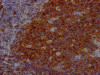 IHC image of CSB-RA780821A0HU diluted at 1:100 and staining in paraffin-embedded human tonsil tissue performed on a Leica BondTM system. After dewaxing and hydration, antigen retrieval was mediated by high pressure in a citrate buffer (pH 6.0). Section was blocked with 10% normal goat serum 30min at RT. Then primary antibody (1% BSA) was incubated at 4°C overnight. The primary is detected by a Goat anti-rabbit IgG polymer labeled by HRP and visualized using 0.05% DAB.