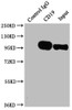 Immunoprecipitating CD19 in Raji whole cell lysate<br />
 Lane 1: Rabbit control IgG instead of CSB-RA780821A0HU in Raji whole cell lysate.
 For western blotting,a HRP-conjugated Protein G antibody was used as the secondary antibody (1/2000)<br />
 Lane 2: CSB-RA780821A0HU（2µg）+ Raji whole cell lysate（500µg）<br />
 Lane 3: Raji whole cell lysate (10µg)<br />