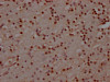 IHC image of CSB-RA782379A0HU diluted at 1:100 and staining in paraffin-embedded human brain tissue performed on a Leica BondTM system. After dewaxing and hydration, antigen retrieval was mediated by high pressure in a citrate buffer (pH 6.0). Section was blocked with 10% normal goat serum 30min at RT. Then primary antibody (1% BSA) was incubated at 4°C overnight. The primary is detected by a Goat anti-rabbit IgG polymer labeled by HRP and visualized using 0.05% DAB.