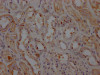 IHC image of CSB-RA797150A0HU diluted at 1:100 and staining in paraffin-embedded human kidney tissue performed on a Leica BondTM system. After dewaxing and hydration, antigen retrieval was mediated by high pressure in a citrate buffer (pH 6.0). Section was blocked with 10% normal goat serum 30min at RT. Then primary antibody (1% BSA) was incubated at 4°C overnight. The primary is detected by a Goat anti-rabbit IgG polymer labeled by HRP and visualized using 0.05% DAB.