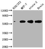 Western Blot<br />
 Positive WB detected in: NIH/3T3 whole cell lysate, MCF-7 whole cell lysate, ntera-2 whole cell lysate, Mouse brain tissue<br />
 All lanes: PAK1 antibody at 1:2000<br />
 Secondary<br />
 Goat polyclonal to rabbit IgG at 1/50000 dilution<br />
 Predicted band size: 61, 62 kDa<br />
 Observed band size: 61 kDa<br />