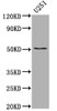 Western Blot<br />
 Positive WB detected in: U-251 whole cell lysate<br />
 All lanes: Mutant p53 antibody at 1:1000<br />
 Secondary<br />
 Goat polyclonal to rabbit IgG at 1/50000 dilution<br />
 Predicted band size: 38, 39, 40, 34, 35, 30, 24, 25 kDa<br />
 Observed band size: 53 kDa<br />