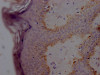IHC image of CSB-RA585595A0HU diluted at 1:100 and staining in paraffin-embedded human skin tissue performed on a Leica BondTM system. After dewaxing and hydration, antigen retrieval was mediated by high pressure in a citrate buffer (pH 6.0). Section was blocked with 10% normal goat serum 30min at RT. Then primary antibody (1% BSA) was incubated at 4°C overnight. The primary is detected by a Goat anti-rabbit IgG polymer labeled by HRP and visualized using 0.05% DAB.