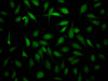 Immunofluorescence staining of Hela Cells with CSB-RA260392A0HU at 1：50, counter-stained with DAPI. The cells were fixed in 4% formaldehyde, permeated by 0.2% TritonX-100, and blocked in 10% normal Goat Serum. The cells were then incubated with the antibody overnight at 4°C. Nuclear DNA was labeled in blue with DAPI. The secondary antibody was FITC-conjugated AffiniPure Goat Anti-Rabbit IgG （H+L）.