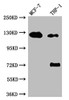 Western Blot<br />
 Positive WB detected in: MCF-7 whole cell lysate, THP-1 whole cell lysate<br />
 All lanes: Androgen Receptor antibody at 1:1000<br />
 Secondary<br />
 Goat polyclonal to rabbit IgG at 1/50000 dilution<br />
 Predicted band size: 100, 45, 68, 68, kDa<br />
 Observed band size: 125 kDa<br />