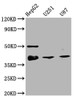 Western Blot<br />
 Positive WB detected in: HepG2 whole cell lysate, U251 whole cell lysate, U87 whole cell lysate<br />
 All lanes: TTF1 antibody at 1:2000<br />
 Secondary<br />
 Goat polyclonal to rabbit IgG at 1/50000 dilution<br />
 Predicted band size: 39 kDa<br />
 Observed band size: 39 kDa<br />