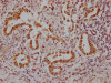 IHC image of CSB-RA181189A0HU diluted at 1:100 and staining in paraffin-embedded human lung tissue performed on a Leica BondTM system. After dewaxing and hydration, antigen retrieval was mediated by high pressure in a citrate buffer (pH 6.0). Section was blocked with 10% normal goat serum 30min at RT. Then primary antibody (1% BSA) was incubated at 4°C overnight. The primary is detected by a Goat anti-rabbit IgG polymer labeled by HRP and visualized using 0.05% DAB.