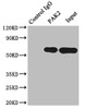 Immunoprecipitating PAK2 in Raji whole cell lysate<br />
 Lane 1: Rabbit control IgG instead of CSB-RA592787A0HU in Raji whole cell lysate.
 For western blotting,a HRP-conjugated Protein G antibody was used as the secondary antibody (1/2000)<br />
 Lane 2: CSB-RA592787A0HU（2µg）+ Raji whole cell lysate（500µg）<br />
 Lane 3: Raji whole cell lysate (10µg)<br />