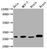 Western Blot<br />
 Positive WB detected in: Hela whole cell lysate, MCF-7 whole cell lysate, Mouse Brain whole cell lysate, Rat Brain whole cell lysate<br />
 All lanes: GRB2 antibody at 1:1000<br />
 Secondary<br />
 Goat polyclonal to rabbit IgG at 1/50000 dilution<br />
 Predicted band size: 26, 21 kDa<br />
 Observed band size: 28 kDa<br />