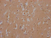 IHC image of CSB-RA802195A0HU diluted at 1:100 and staining in paraffin-embedded human brain tissue performed on a Leica BondTM system. After dewaxing and hydration, antigen retrieval was mediated by high pressure in a citrate buffer (pH 6.0). Section was blocked with 10% normal goat serum 30min at RT. Then primary antibody (1% BSA) was incubated at 4°C overnight. The primary is detected by a Goat anti-rabbit IgG polymer labeled by HRP and visualized using 0.05% DAB.