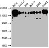 Western Blot<br />
 Positive WB detected in: Hela whole cell lysate, Jurkat whole cell lysate, 293 whole cell lysate, MCF-7 whole cell lysate, 293T whole cell lysate, HepG2 whole cell lysate<br />
 All lanes: PELP1 antibody at 1:1000<br />
 Secondary<br />
 Goat polyclonal to rabbit IgG at 1/50000 dilution<br />
 Predicted band size: 120 kDa<br />
 Observed band size: 160 kDa<br />