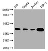 Western Blot<br />
 Positive WB detected in: 293 whole cell lysate, HepG2 whole cell lysate, Jurkat whole cell lysate, THP-1 whole cell lysate<br />
 All lanes: TMEM173 antibody at 1:1000<br />
 Secondary<br />
 Goat polyclonal to rabbit IgG at 1/50000 dilution<br />
 Predicted band size: 43 kDa<br />
 Observed band size: 43 kDa<br />