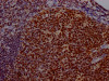IHC image of CSB-RA192026A0HU diluted at 1:100 and staining in paraffin-embedded human tonsil tissue performed on a Leica BondTM system. After dewaxing and hydration, antigen retrieval was mediated by high pressure in a citrate buffer (pH 6.0). Section was blocked with 10% normal goat serum 30min at RT. Then primary antibody (1% BSA) was incubated at 4°C overnight. The primary is detected by a Goat anti-rabbit IgG polymer labeled by HRP and visualized using 0.05% DAB.