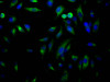 Immunofluorescence staining of Hela Cells with CSB-RA192026A0HU at 1：50, counter-stained with DAPI. The cells were fixed in 4% formaldehyde, permeated by 0.2% TritonX-100, and blocked in 10% normal Goat Serum. The cells were then incubated with the antibody overnight at 4°C. Nuclear DNA was labeled in blue with DAPI. The secondary antibody was FITC-conjugated AffiniPure Goat Anti-Rabbit IgG （H+L）.