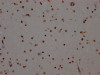 IHC image of CSB-RA906343A0HU diluted at 1:100 and staining in paraffin-embedded human brain tissue performed on a Leica BondTM system. After dewaxing and hydration, antigen retrieval was mediated by high pressure in a citrate buffer (pH 6.0). Section was blocked with 10% normal goat serum 30min at RT. Then primary antibody (1% BSA) was incubated at 4°C overnight. The primary is detected by a Goat anti-rabbit IgG polymer labeled by HRP and visualized using 0.05% DAB.