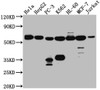 Western Blot<br />
 Positive WB detected in: Hela whole cell lysate, HepG2 whole cell lysate, PC-3 whole cell lysate, K562 whole cell lysate, HL-60 whole cell lysate, MCF-7 whole cell lysate, Jurkat whole cell lysate<br />
 All lanes: PTBP1 antibody at 1:1000<br />
 Secondary<br />
 Goat polyclonal to rabbit IgG at 1/50000 dilution<br />
 Predicted band size: 58, 60, 60 kDa<br />
 Observed band size: 58 kDa<br />