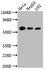 Western Blot<br />
 Positive WB detected in: Hela whole cell lysate, HepG2 whole cell lysate, L02 whole cell lysate<br />
 All lanes: CYP1A2 antibody at 1:1000<br />
 Secondary<br />
 Goat polyclonal to rabbit IgG at 1/50000 dilution<br />
 Predicted band size: 59 kDa<br />
 Observed band size: 59 kDa<br />