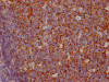 IHC image of CSB-RA714310A0HU diluted at 1:100 and staining in paraffin-embedded human tonsil tissue performed on a Leica BondTM system. After dewaxing and hydration, antigen retrieval was mediated by high pressure in a citrate buffer (pH 6.0). Section was blocked with 10% normal goat serum 30min at RT. Then primary antibody (1% BSA) was incubated at 4°C overnight. The primary is detected by a Goat anti-rabbit IgG polymer labeled by HRP and visualized using 0.05% DAB.
