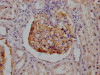 IHC image of CSB-RA714310A0HU diluted at 1:100 and staining in paraffin-embedded human kidney tissue performed on a Leica BondTM system. After dewaxing and hydration, antigen retrieval was mediated by high pressure in a citrate buffer (pH 6.0). Section was blocked with 10% normal goat serum 30min at RT. Then primary antibody (1% BSA) was incubated at 4°C overnight. The primary is detected by a Goat anti-rabbit IgG polymer labeled by HRP and visualized using 0.05% DAB.