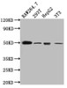 Western Blot<br />
 Positive WB detected in: RAW264.7 whole cell lysate, 293T whole cell lysate, HepG2 whole cell lysate, NIH/3T3 whole cell lysate<br />
 All lanes: TIM1 antibody at 1:1000<br />
 Secondary<br />
 Goat polyclonal to rabbit IgG at 1/50000 dilution<br />
 Predicted band size: 40 kDa<br />
 Observed band size: 50 kDa<br />