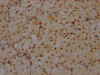 IHC image of CSB-RA930964A0HU diluted at 1:100 and staining in paraffin-embedded human ovarian tissue performed on a Leica BondTM system. After dewaxing and hydration, antigen retrieval was mediated by high pressure in a citrate buffer (pH 6.0). Section was blocked with 10% normal goat serum 30min at RT. Then primary antibody (1% BSA) was incubated at 4°C overnight. The primary is detected by a Goat anti-rabbit IgG polymer labeled by HRP and visualized using 0.05% DAB.