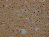 IHC image of CSB-RA930964A0HU diluted at 1:100 and staining in paraffin-embedded human brain tissue performed on a Leica BondTM system. After dewaxing and hydration, antigen retrieval was mediated by high pressure in a citrate buffer (pH 6.0). Section was blocked with 10% normal goat serum 30min at RT. Then primary antibody (1% BSA) was incubated at 4°C overnight. The primary is detected by a Goat anti-rabbit IgG polymer labeled by HRP and visualized using 0.05% DAB.