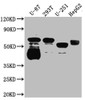 Western Blot<br />
 Positive WB detected in: U-87 whole cell lysate, 293T whole cell lysate, U-251 whole cell lysate, HepG2 whole cell lysate<br />
 All lanes: Serotonin transporter antibody at 1:1000<br />
 Secondary<br />
 Goat polyclonal to rabbit IgG at 1/50000 dilution<br />
 Predicted band size: 71, 75 kDa<br />
 Observed band size: 55 kDa<br />