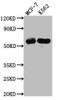 Western Blot<br />
 Positive WB detected in: MCF-7 whole cell lysate, K562 whole cell lysate<br />
 All lanes: HDAC2 antibody at 1:1000<br />
 Secondary<br />
 Goat polyclonal to rabbit IgG at 1/50000 dilution<br />
 Predicted band size: 56, 52 kDa<br />
 Observed band size: 60 kDa<br />