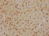 IHC image of CSB-RA949799A0HU diluted at 1:100 and staining in paraffin-embedded human brain tissue performed on a Leica BondTM system. After dewaxing and hydration, antigen retrieval was mediated by high pressure in a citrate buffer (pH 6.0). Section was blocked with 10% normal goat serum 30min at RT. Then primary antibody (1% BSA) was incubated at 4°C overnight. The primary is detected by a Goat anti-rabbit IgG polymer labeled by HRP and visualized using 0.05% DAB.