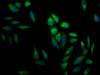 Immunofluorescence staining of Hela Cells with CSB-RA187762A0HU at 1：50, counter-stained with DAPI. The cells were fixed in 4% formaldehyde, permeated by 0.2% TritonX-100, and blocked in 10% normal Goat Serum. The cells were then incubated with the antibody overnight at 4°C. Nuclear DNA was labeled in blue with DAPI. The secondary antibody was FITC-conjugated AffiniPure Goat Anti-Rabbit IgG （H+L）.