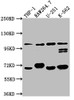 Western Blot<br />
 Positive WB detected in: THP-1 whole cell lysate, RAW264.7 whole cell lysate, U-251 whole cell lysate, K562 whole cell lysate<br />
 All lanes: TLR5 antibody at 1:1000<br />
 Secondary<br />
 Goat polyclonal to rabbit IgG at 1/50000 dilution<br />
 Predicted band size: 98 kDa<br />
 Observed band size: 98 kDa<br />