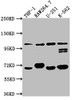 Western Blot<br />
 Positive WB detected in: THP-1 whole cell lysate, RAW264.7 whole cell lysate, U-251 whole cell lysate, K562 whole cell lysate<br />
 All lanes: TLR5 antibody at 1:1000<br />
 Secondary<br />
 Goat polyclonal to rabbit IgG at 1/50000 dilution<br />
 Predicted band size: 98 kDa<br />
 Observed band size: 98 kDa<br />