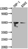Western Blot<br />
 Positive WB detected in: THP-1 whole cell lysate, K562 whole cell lysate<br />
 All lanes: FDFT1 antibody at 1:1000<br />
 Secondary<br />
 Goat polyclonal to rabbit IgG at 1/50000 dilution<br />
 Predicted band size: 49, 41, 39, 36, 44 kDa<br />
 Observed band size: 50 kDa<br />