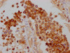 IHC image of CSB-RA909932A0HU diluted at 1:100 and staining in paraffin-embedded human testis tissue performed on a Leica BondTM system. After dewaxing and hydration, antigen retrieval was mediated by high pressure in a citrate buffer (pH 6.0). Section was blocked with 10% normal goat serum 30min at RT. Then primary antibody (1% BSA) was incubated at 4°C overnight. The primary is detected by a Goat anti-rabbit IgG polymer labeled by HRP and visualized using 0.05% DAB.
