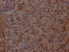 IHC image of CSB-RA941933A0HU diluted at 1:100 and staining in paraffin-embedded human adrenal gland tissue performed on a Leica BondTM system. After dewaxing and hydration, antigen retrieval was mediated by high pressure in a citrate buffer (pH 6.0). Section was blocked with 10% normal goat serum 30min at RT. Then primary antibody (1% BSA) was incubated at 4°C overnight. The primary is detected by a Goat anti-rabbit IgG polymer labeled by HRP and visualized using 0.05% DAB.