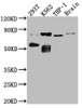 Western Blot<br />
 Positive WB detected in: 293T whole cell lysate, K562 whole cell lysate, THP-1 whole cell lysate, Mouse Brain whole cell lysate<br />
 All lanes: PKC antibody at 1:1000<br />
 Secondary<br />
 Goat polyclonal to rabbit IgG at 1/50000 dilution<br />
 Predicted band size: 82, 75, 68 kDa<br />
 Observed band size: 82, 55 kDa<br />