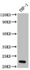 Western Blot<br />
 Positive WB detected in: THP-1 whole cell lysate<br />
 All lanes: IL23 antibody at 1:1000<br />
 Secondary<br />
 Goat polyclonal to rabbit IgG at 1/50000 dilution<br />
 Predicted band size: 21 kDa<br />
 Observed band size: 21 kDa<br />