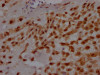 IHC image of CSB-RA196111A0HU diluted at 1:100 and staining in paraffin-embedded human placenta tissue performed on a Leica BondTM system. After dewaxing and hydration, antigen retrieval was mediated by high pressure in a citrate buffer (pH 6.0). Section was blocked with 10% normal goat serum 30min at RT. Then primary antibody (1% BSA) was incubated at 4°C overnight. The primary is detected by a Goat anti-rabbit IgG polymer labeled by HRP and visualized using 0.05% DAB.