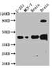 Western Blot<br />
 Positive WB detected in: U-251 whole cell lysate, MCF-7 whole cell lysate, Mouse Brain whole cell lysate, Rat Brain whole cell lysate<br />
 All lanes: SOX2 antibody at 1:1000<br />
 Secondary<br />
 Goat polyclonal to rabbit IgG at 1/50000 dilution<br />
 Predicted band size: 35 kDa<br />
 Observed band size: 40 kDa<br />