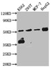 Western Blot<br />
 Positive WB detected in: K562 whole cell lysate, 293T whole cell lysate, MCF-7 whole cell lysate, HepG2 whole cell lysate<br />
 All lanes: Chk1 antibody at 1:1000<br />
 Secondary<br />
 Goat polyclonal to rabbit IgG at 1/50000 dilution<br />
 Predicted band size: 55, 44, 51 kDa<br />
 Observed band size: 55 kDa<br />